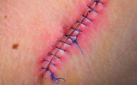 infection prevention CE courses